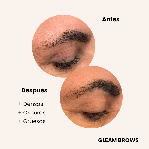 resultados-gleam-brows-cejas